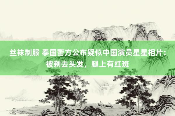 丝袜制服 泰国警方公布疑似中国演员星星相片：被剃去头发，腿上有红斑